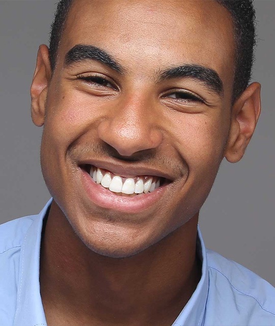 img-trmt-bracesbehind-01